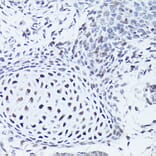 Immunohistochemistry - Anti-SOX5 Antibody (A15465) - Antibodies.com