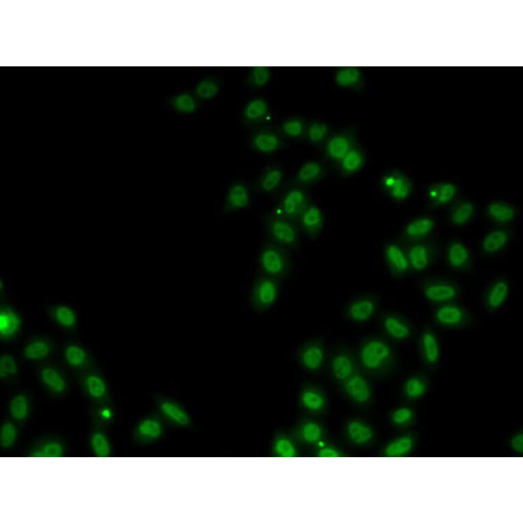 Immunofluorescence - Anti-SOX5 Antibody (A15465) - Antibodies.com