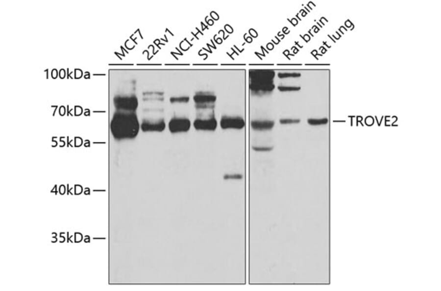 Western Blot - Anti-TROVE2/SS-A Antibody (A15466) - Antibodies.com