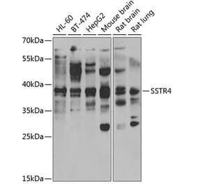 Western Blot - Anti-SSTR4 Antibody (A15467) - Antibodies.com