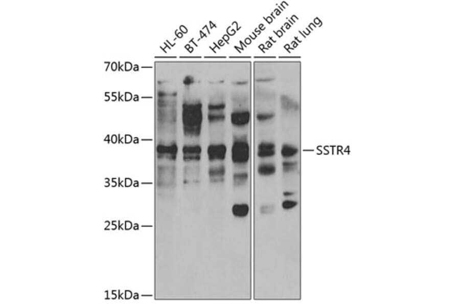 Western Blot - Anti-SSTR4 Antibody (A15467) - Antibodies.com