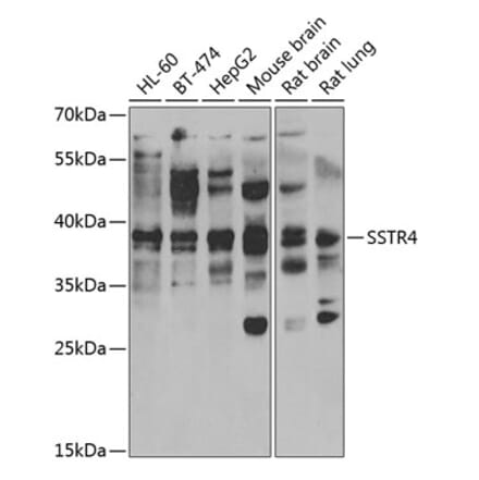 Western Blot - Anti-SSTR4 Antibody (A15467) - Antibodies.com