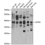 Western Blot - Anti-SSTR4 Antibody (A15467) - Antibodies.com