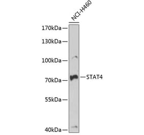 Western Blot - Anti-STAT4 Antibody (A15468) - Antibodies.com