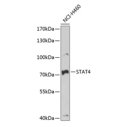 Western Blot - Anti-STAT4 Antibody (A15468) - Antibodies.com