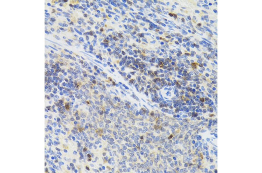 Immunohistochemistry - Anti-STAT4 Antibody (A15468) - Antibodies.com