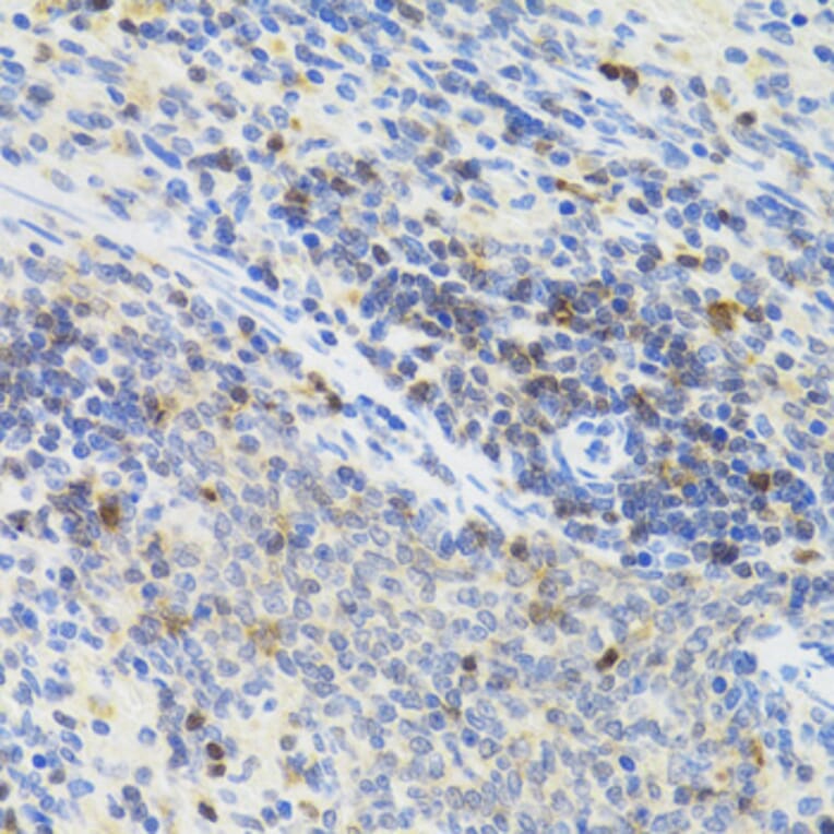 Immunohistochemistry - Anti-STAT4 Antibody (A15468) - Antibodies.com