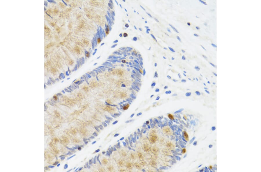 Immunohistochemistry - Anti-STAT4 Antibody (A15468) - Antibodies.com