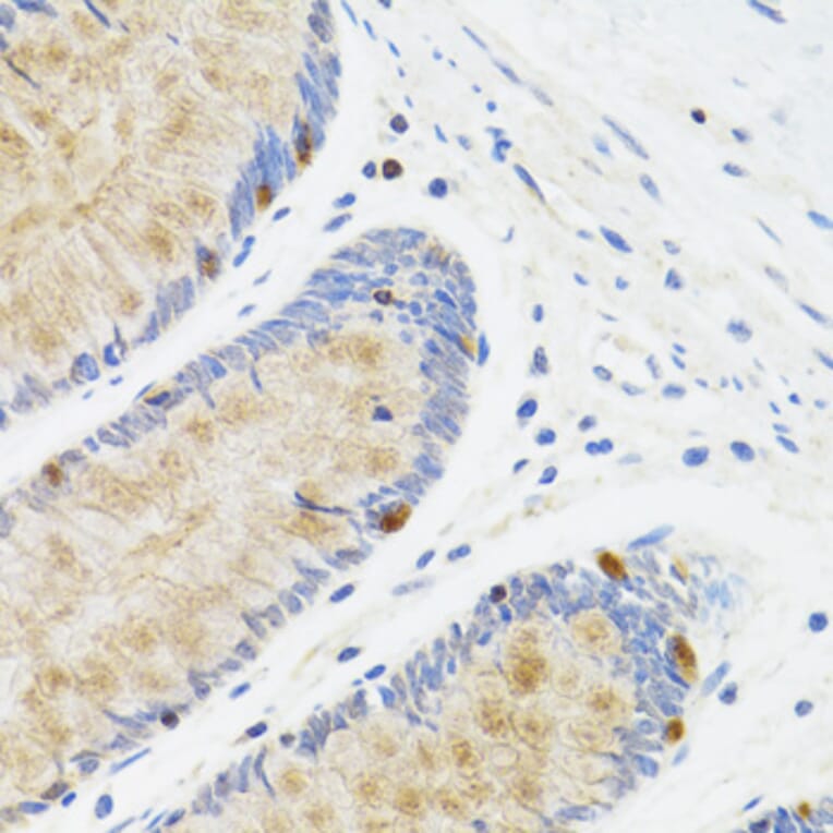Immunohistochemistry - Anti-STAT4 Antibody (A15468) - Antibodies.com
