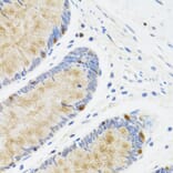 Immunohistochemistry - Anti-STAT4 Antibody (A15468) - Antibodies.com