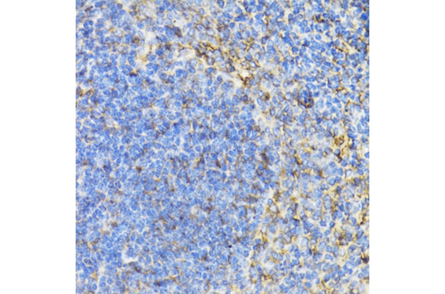 Immunohistochemistry - Anti-STAT4 Antibody (A15468) - Antibodies.com