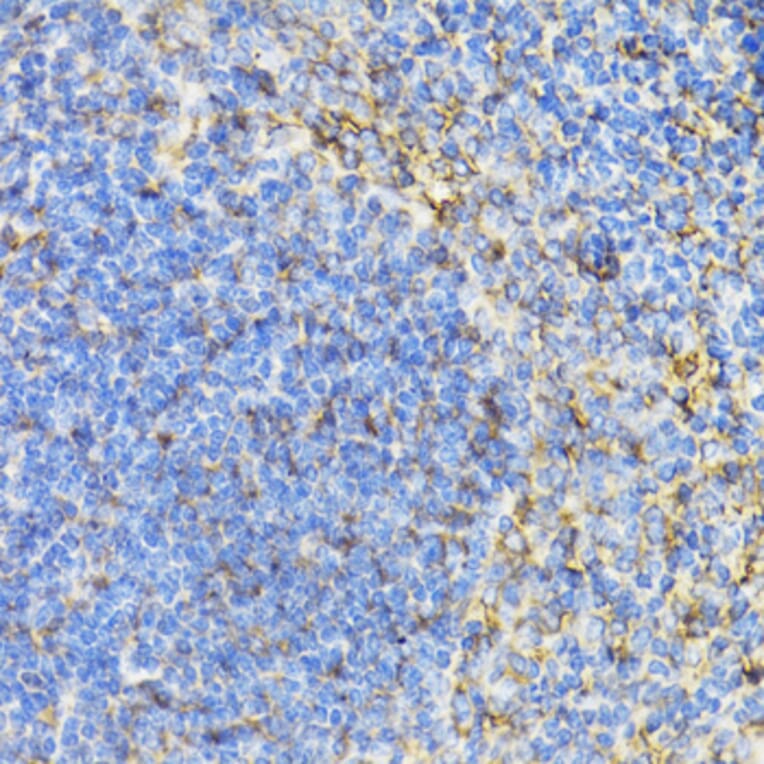 Immunohistochemistry - Anti-STAT4 Antibody (A15468) - Antibodies.com