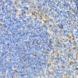 Immunohistochemistry - Anti-STAT4 Antibody (A15468) - Antibodies.com