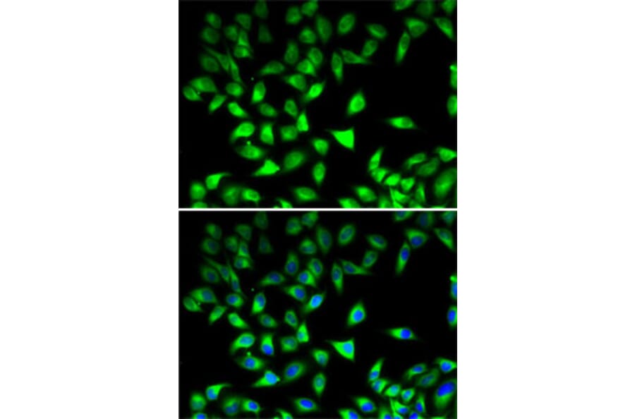 Immunofluorescence - Anti-STAT4 Antibody (A15468) - Antibodies.com