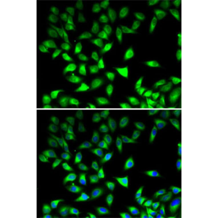 Immunofluorescence - Anti-STAT4 Antibody (A15468) - Antibodies.com