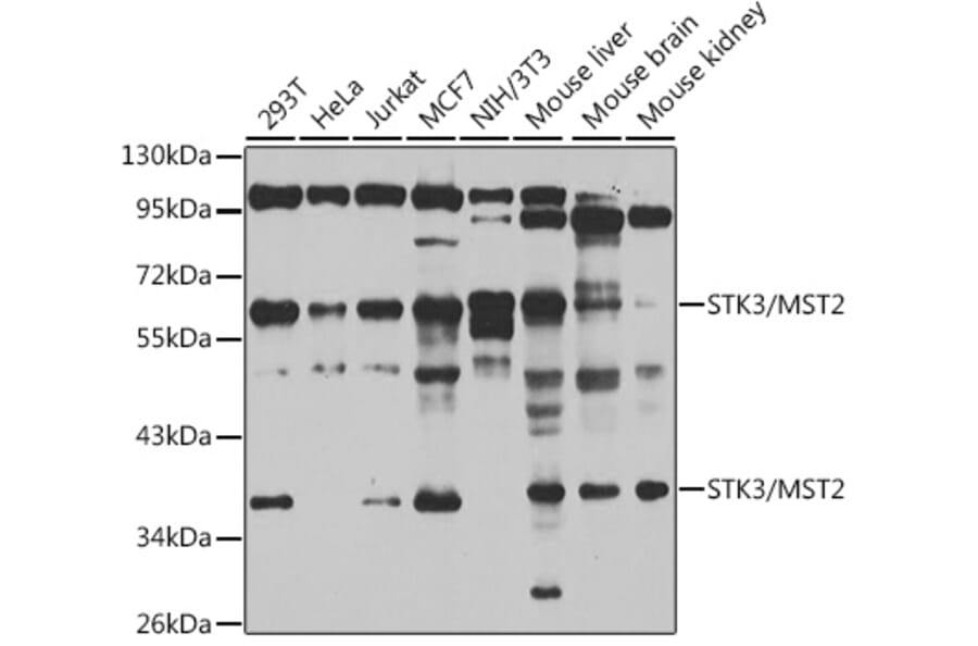 Western Blot - Anti-STK3/MST-2 Antibody (A15469) - Antibodies.com