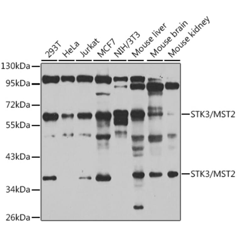 Western Blot - Anti-STK3/MST-2 Antibody (A15469) - Antibodies.com