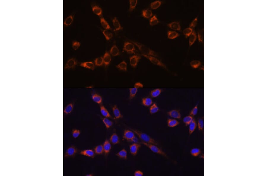 Immunofluorescence - Anti-STK3/MST-2 Antibody (A15469) - Antibodies.com