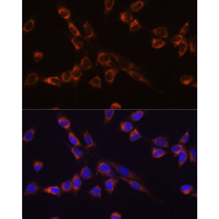Immunofluorescence - Anti-STK3/MST-2 Antibody (A15469) - Antibodies.com