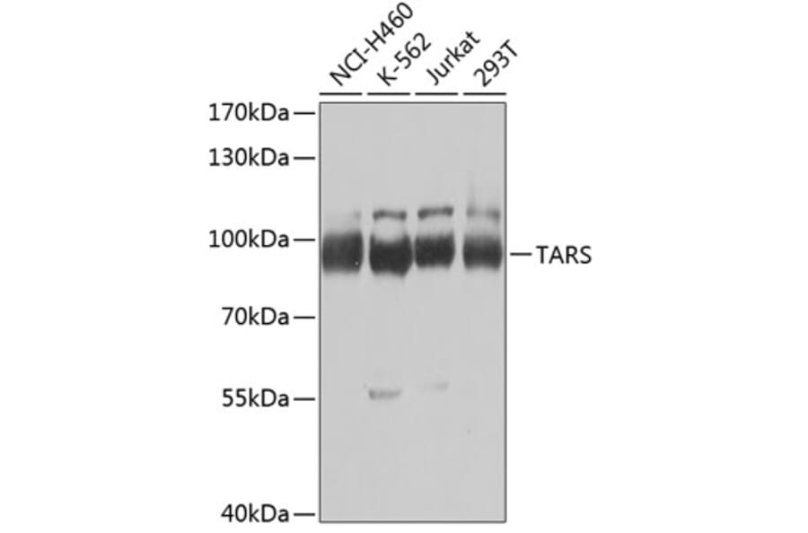 Western Blot - Anti-ThrRS Antibody (A15470) - Antibodies.com
