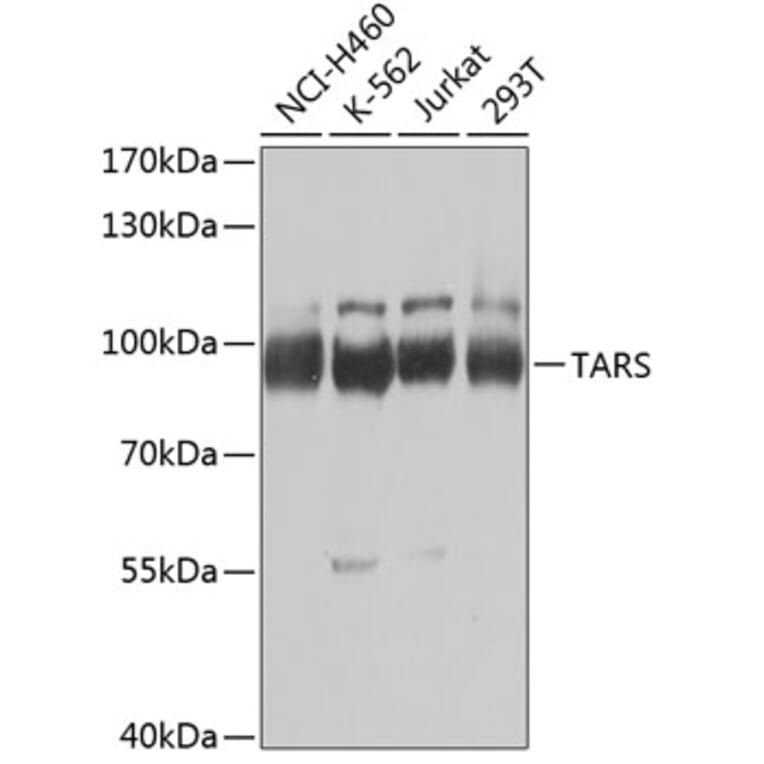 Western Blot - Anti-ThrRS Antibody (A15470) - Antibodies.com