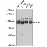 Western Blot - Anti-ThrRS Antibody (A15470) - Antibodies.com