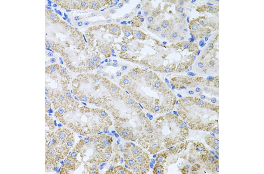 Immunohistochemistry - Anti-ThrRS Antibody (A15470) - Antibodies.com
