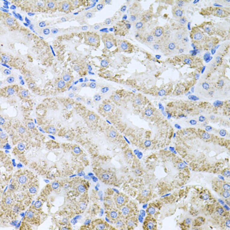 Immunohistochemistry - Anti-ThrRS Antibody (A15470) - Antibodies.com