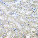 Immunohistochemistry - Anti-ThrRS Antibody (A15470) - Antibodies.com