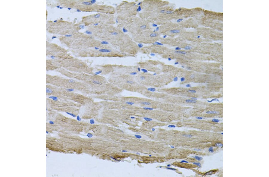 Immunohistochemistry - Anti-ThrRS Antibody (A15470) - Antibodies.com
