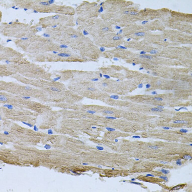 Immunohistochemistry - Anti-ThrRS Antibody (A15470) - Antibodies.com