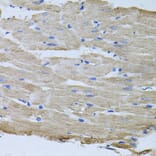 Immunohistochemistry - Anti-ThrRS Antibody (A15470) - Antibodies.com
