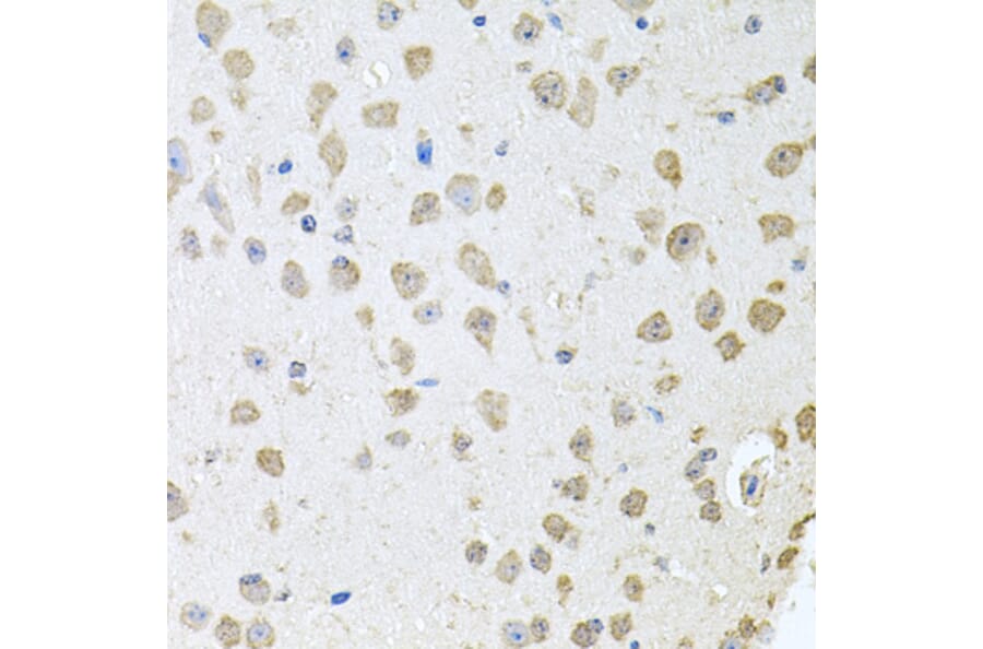 Immunohistochemistry - Anti-ThrRS Antibody (A15470) - Antibodies.com