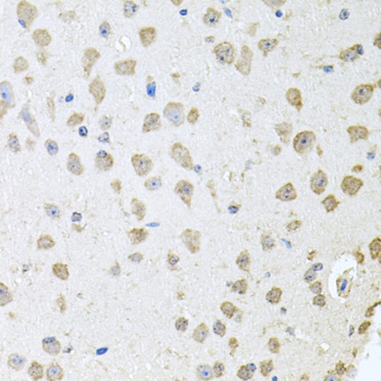 Immunohistochemistry - Anti-ThrRS Antibody (A15470) - Antibodies.com