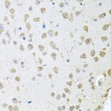 Immunohistochemistry - Anti-ThrRS Antibody (A15470) - Antibodies.com