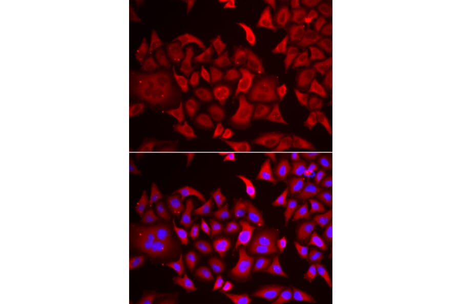 Immunofluorescence - Anti-ThrRS Antibody (A15470) - Antibodies.com