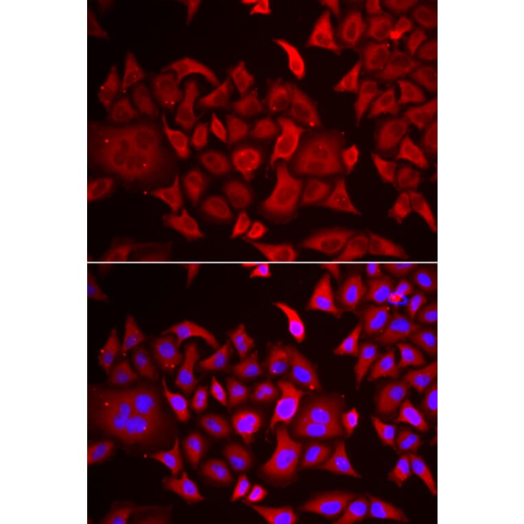 Immunofluorescence - Anti-ThrRS Antibody (A15470) - Antibodies.com