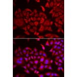 Immunofluorescence - Anti-ThrRS Antibody (A15470) - Antibodies.com