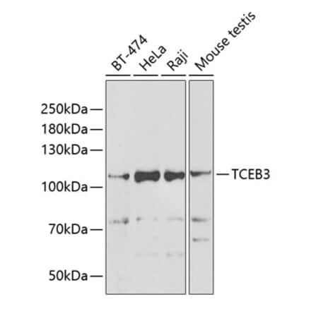 Western Blot - Anti-Elongin-A Antibody (A15471) - Antibodies.com