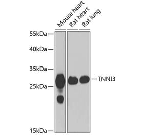Western Blot - Anti-Cardiac Troponin I Antibody (A15472) - Antibodies.com