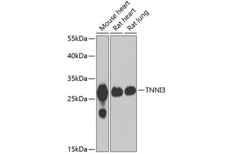Western Blot - Anti-Cardiac Troponin I Antibody (A15472) - Antibodies.com