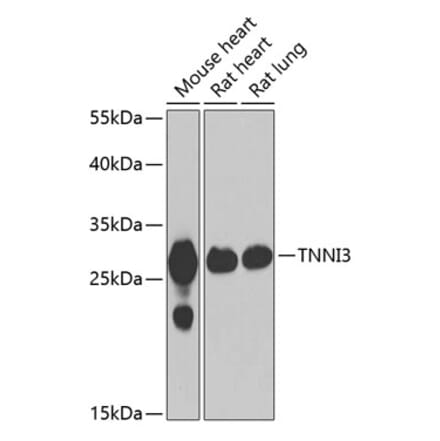 Western Blot - Anti-Cardiac Troponin I Antibody (A15472) - Antibodies.com