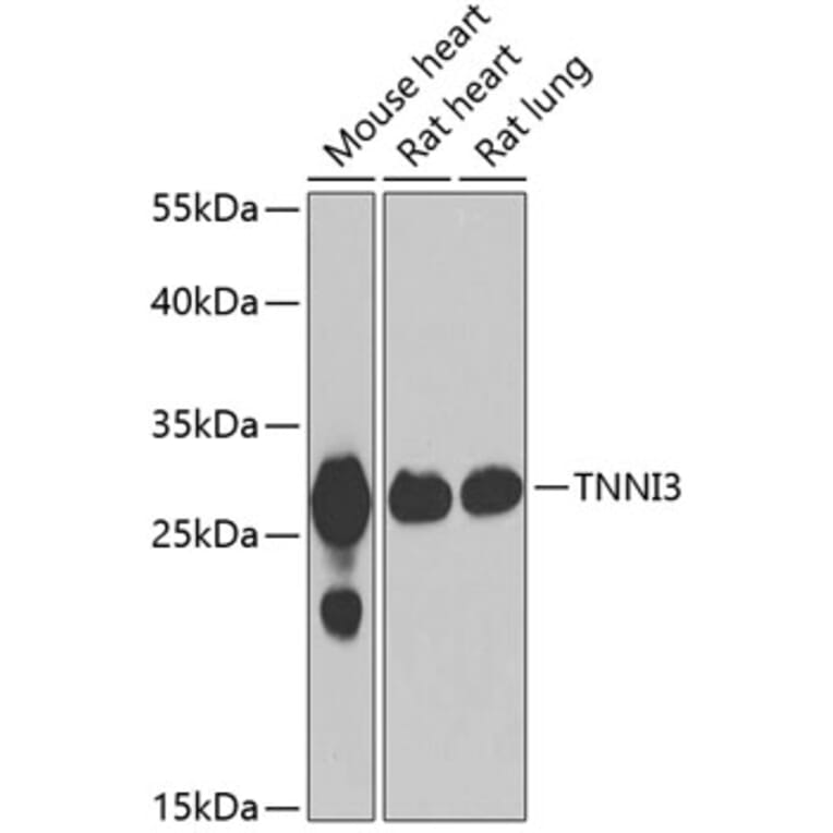 Western Blot - Anti-Cardiac Troponin I Antibody (A15472) - Antibodies.com