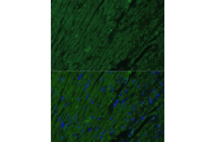 Immunofluorescence - Anti-Cardiac Troponin I Antibody (A15472) - Antibodies.com