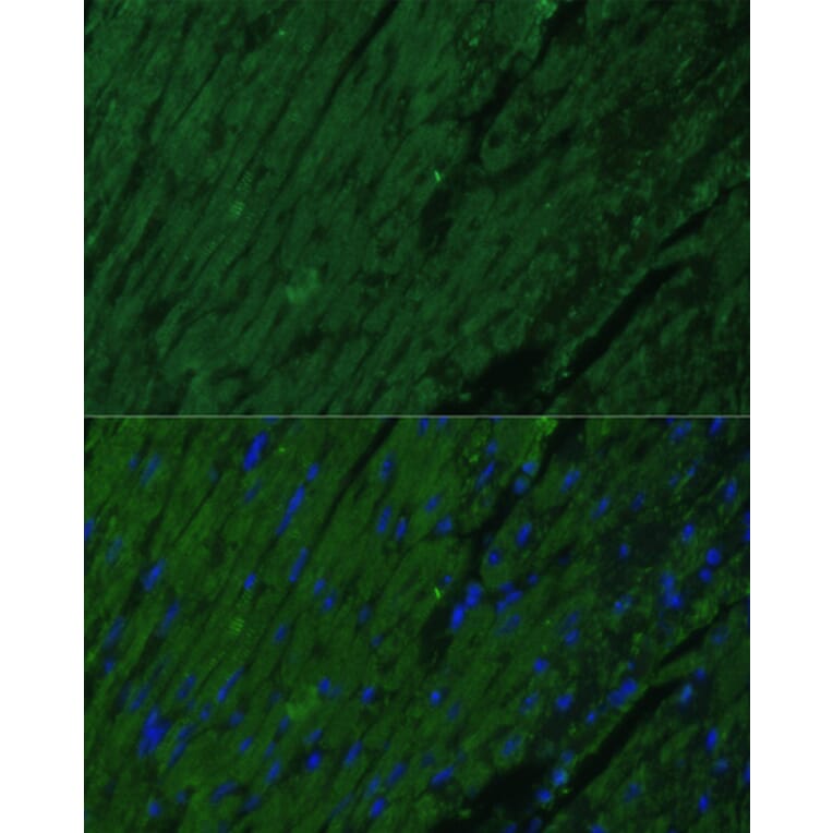 Immunofluorescence - Anti-Cardiac Troponin I Antibody (A15472) - Antibodies.com