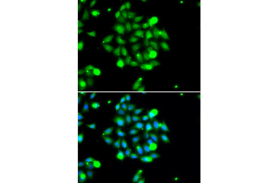 Immunofluorescence - Anti-UBE2G1 Antibody (A6997) - Antibodies.com
