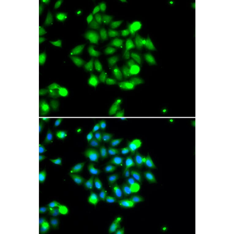 Immunofluorescence - Anti-UBE2G1 Antibody (A6997) - Antibodies.com