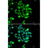 Immunofluorescence - Anti-UBE2G1 Antibody (A6997) - Antibodies.com