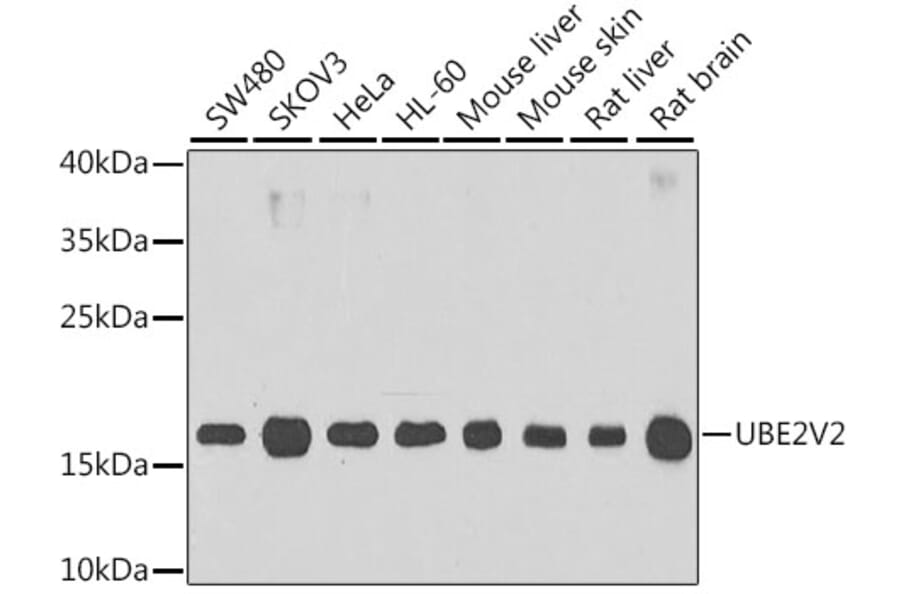 Western Blot - Anti-MMS2 Antibody (A15474) - Antibodies.com
