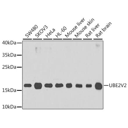 Western Blot - Anti-MMS2 Antibody (A15474) - Antibodies.com